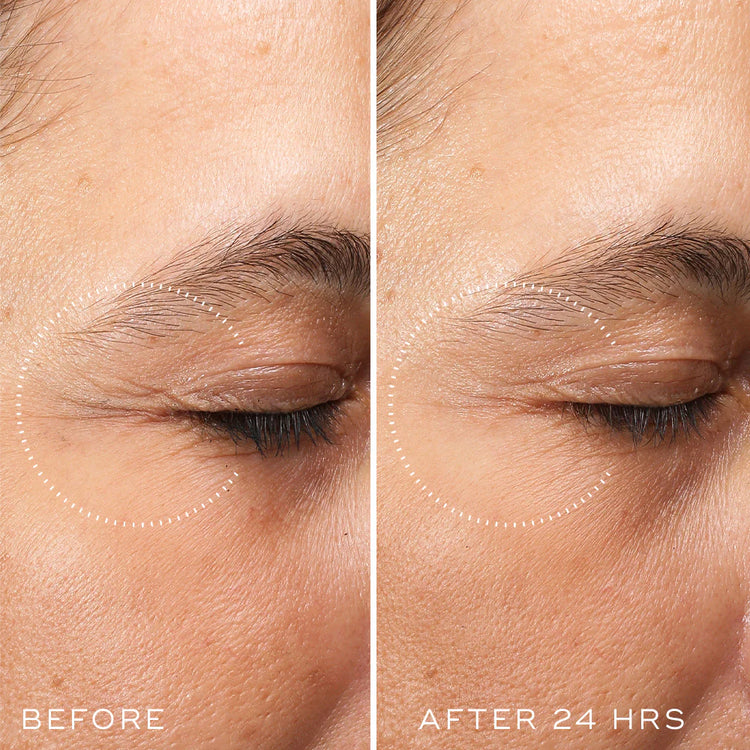 Medik8 Crystal Ceramide Eye 6 15ml