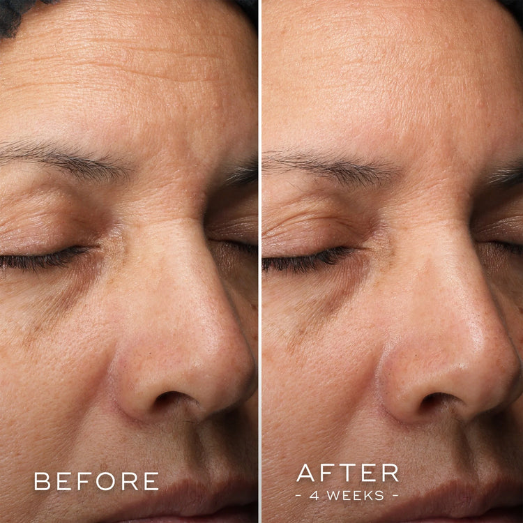 Medik8 C-Tetra Luxe 30ml