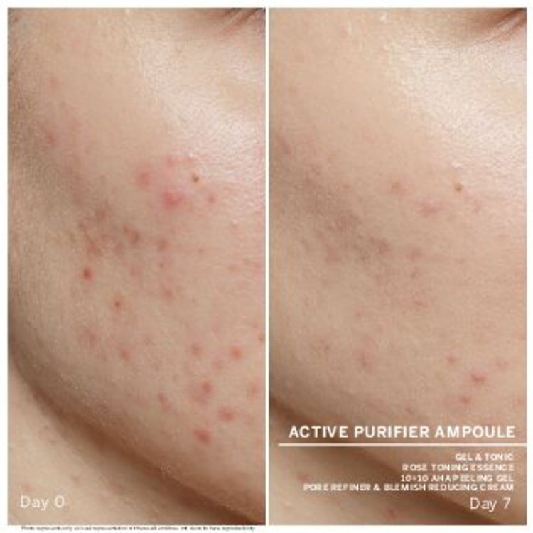 Babor Active Purifier 7x2ml