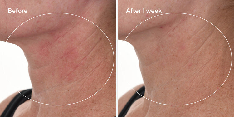 Murad Cellular Hydration Repair Serum 30ml