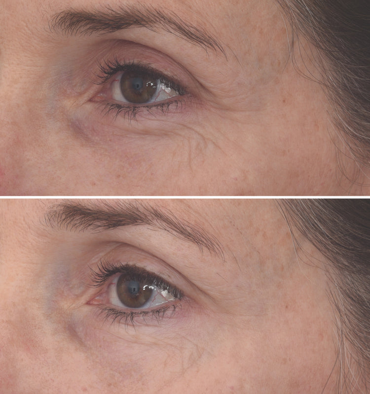 Murad Retinal ReSculpt Eye Treatment 15ml