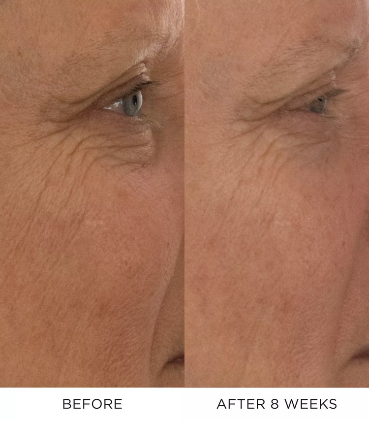 Noble Panacea The Absolute Restoring Eye Cream Refill 30 Doses