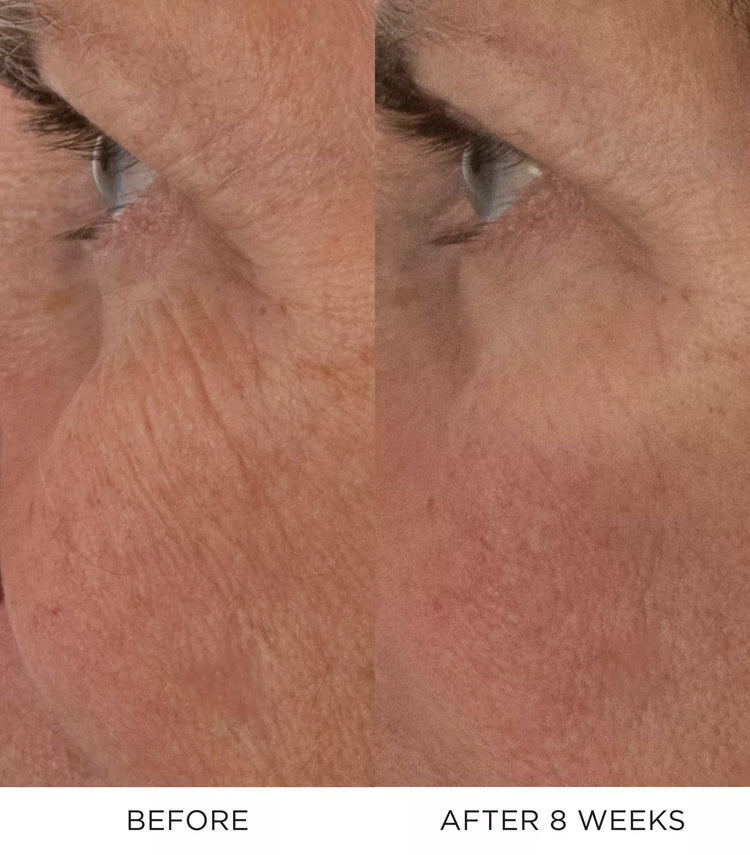 Noble Panacea The Absolute Rejuvenation Night Balm Refill 30 Doses