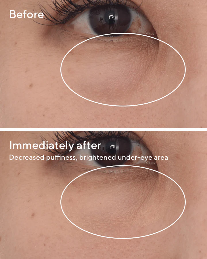 Murad Targeted Eye Depuffer 15ml