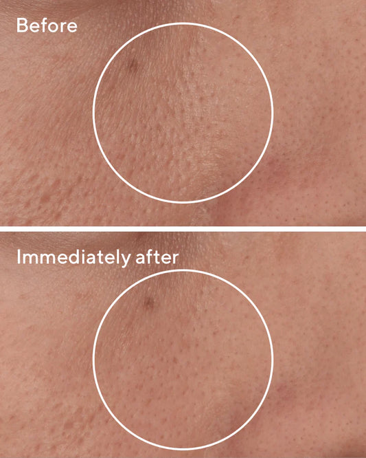 Murad Targeted Pore Corrector 15ml