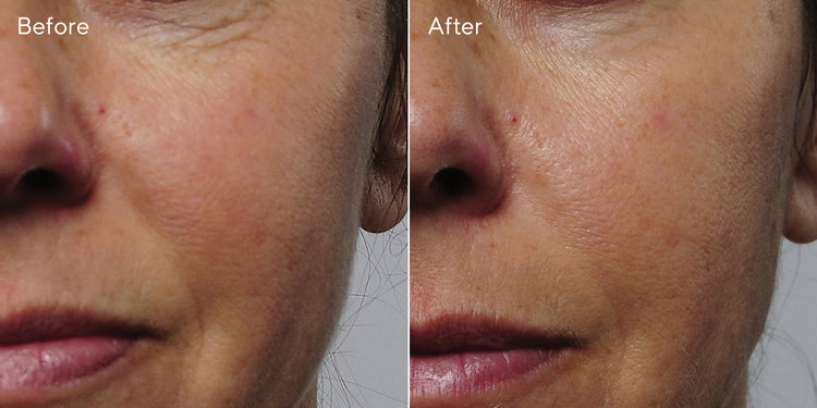 Murad Rapid Collagen Infusion 30ml